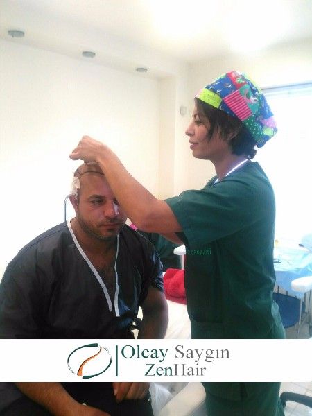 زراعة الشعر في تركيا الدكتورة اولجاي سايقن
